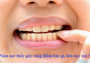 Nằm mơ thấy gãy răng điềm báo gì, hên hay xui ?